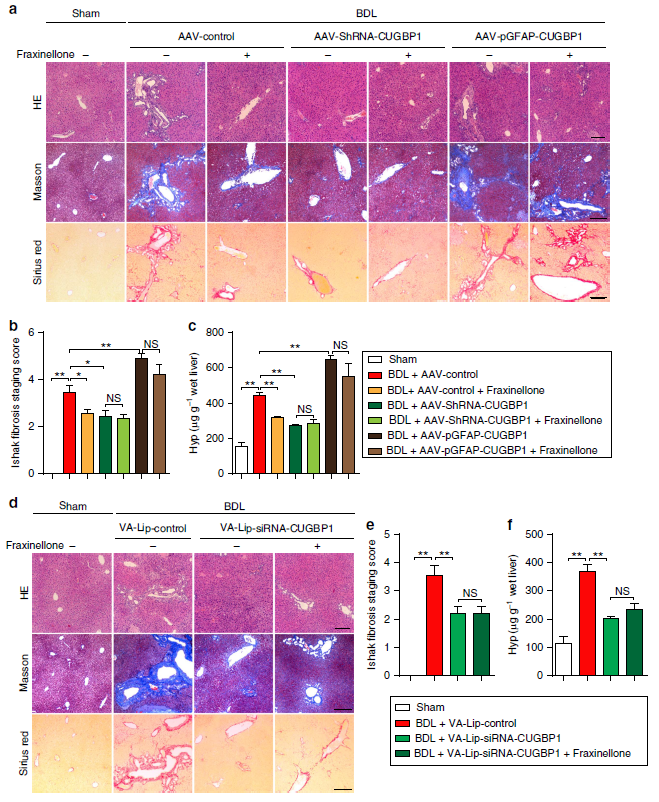 肝脏用什么仪器检查AAV在肝脏中的应用_https://www.jmylbn.com_新闻资讯_第3张