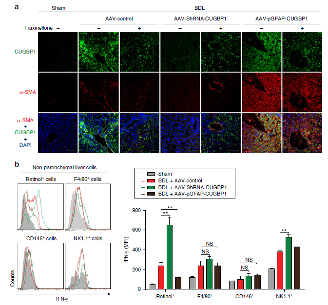 肝脏用什么仪器检查AAV在肝脏中的应用_https://www.jmylbn.com_新闻资讯_第4张
