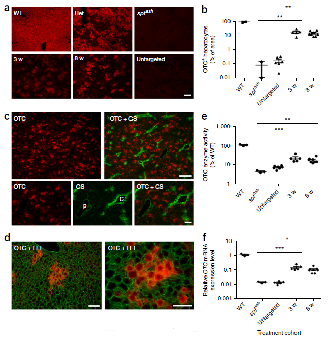 肝脏用什么仪器检查AAV在肝脏中的应用_https://www.jmylbn.com_新闻资讯_第7张